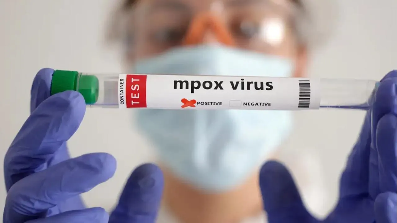 mpox