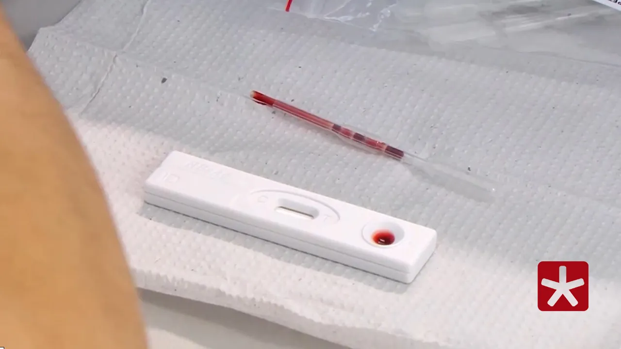  Minas Gerais registra quase 9 mil novos diagnósticos de HIV em dois anos