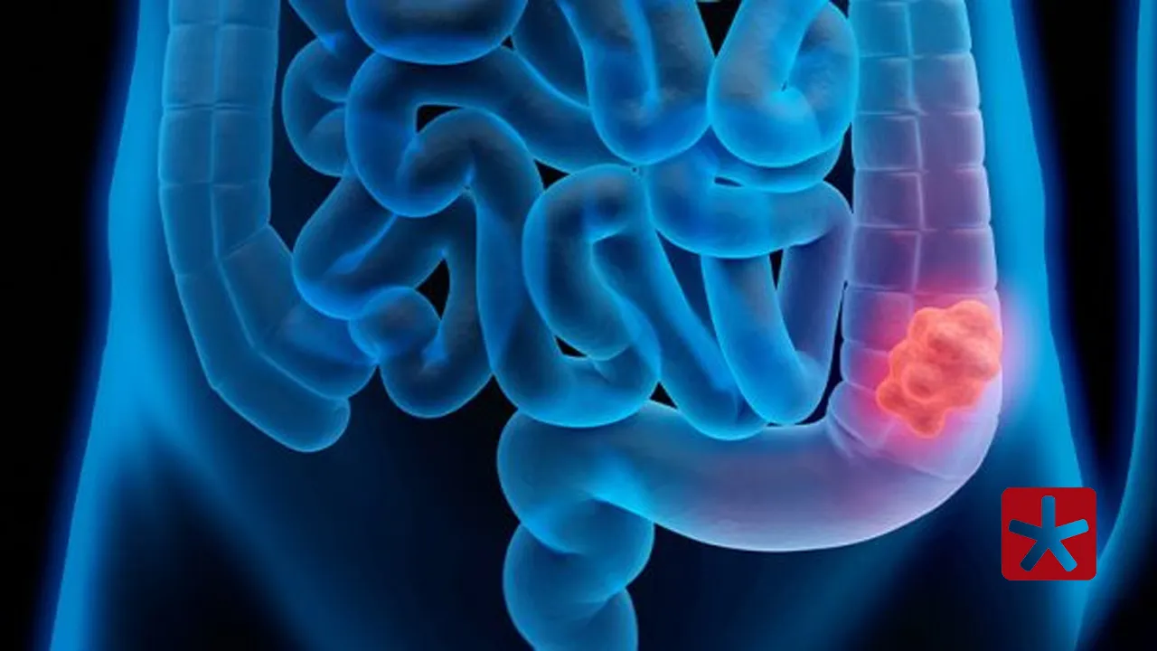 Doença é conhecida por surgir na faixa etária dos 50 anos, mas essa idade tem diminuído